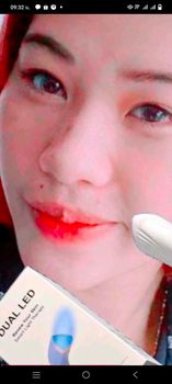 Acne-Derm Dual LED at Home Device -FDA approved for mild to moderate acne.