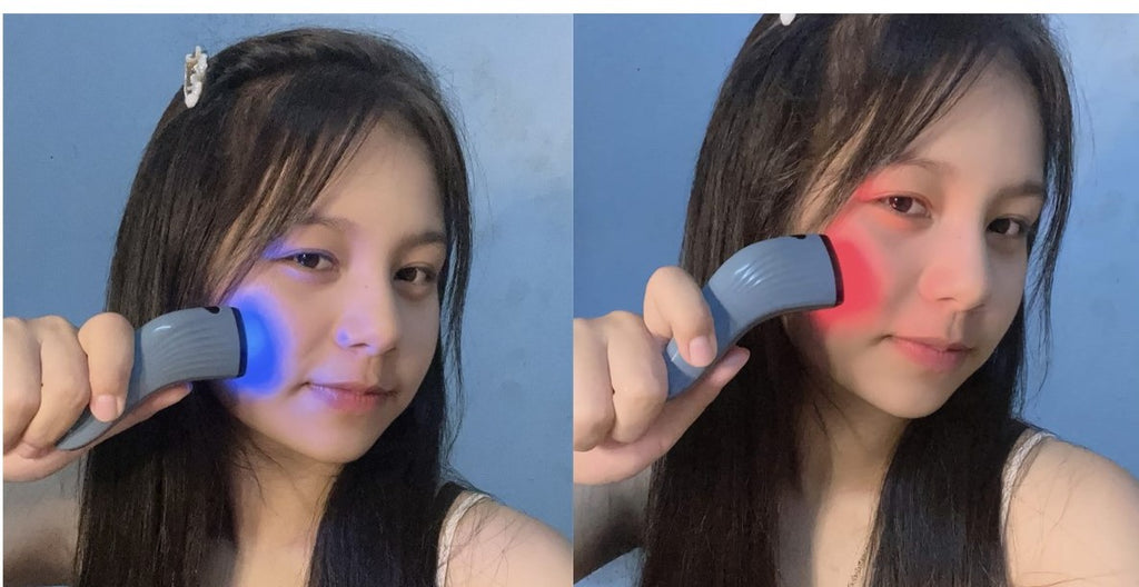 ACNE-DERM -DUAL LED Light –The Future of Acne Treatment