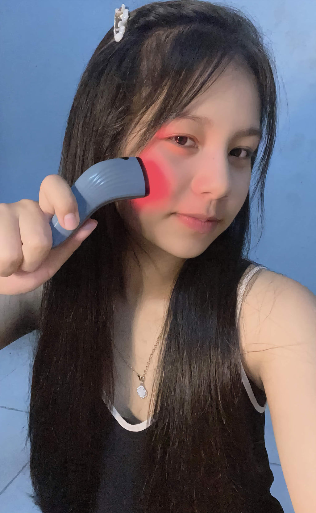 ACNE-DERM -DUAL LED Light –The Future of Acne Treatment