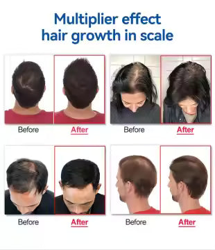 REVIVE Hair Growth Laser Helmet by La Beaute