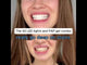 TEETH WHITENING AND GUM CARE SYSTEM